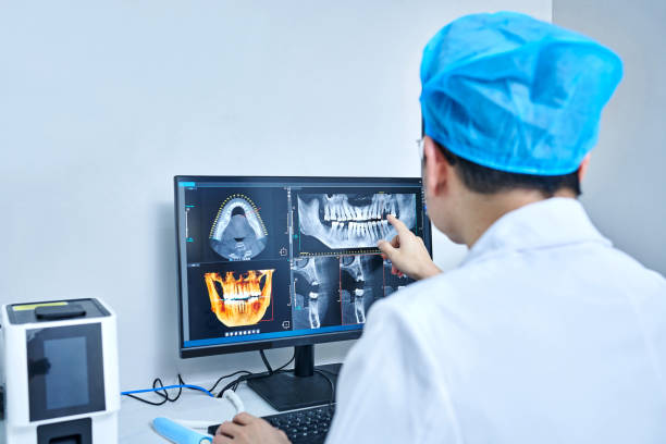 Best Emergency Wisdom Tooth Extraction in Capitol Heights, MD